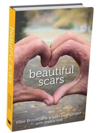 'Beautiful Scars' is the book telling the story of Kilee Brookbank, who was burned in a gas explosion